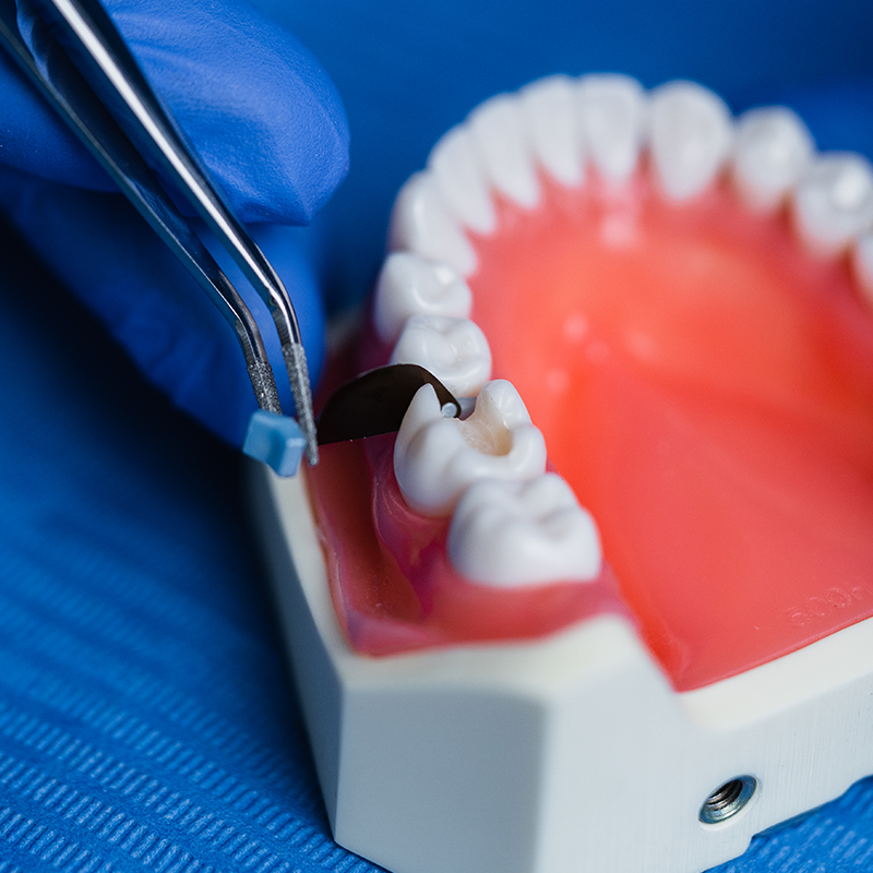 Fendermate D-Coat **NEW**