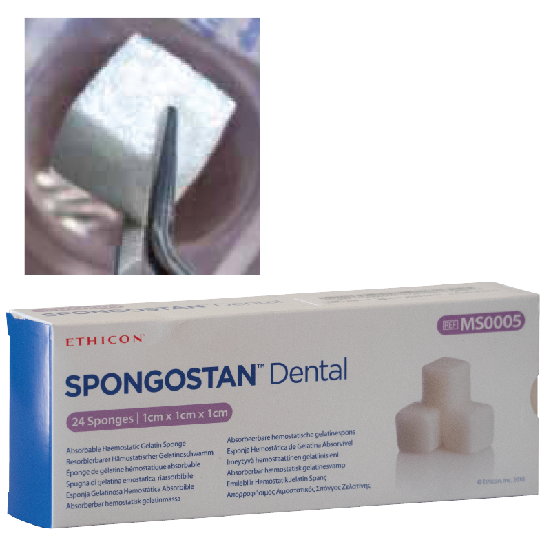 Spongostan – Independent Dental Supplies